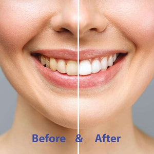 Chomp whitening toothpaste