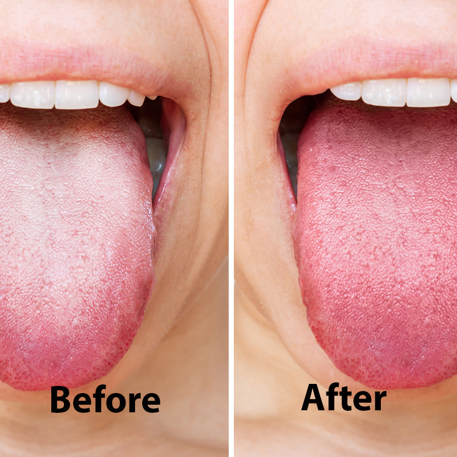 Chomp tongue scraper combo pack